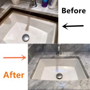 Complete Sink Repair Kit System-Undermount Sink Installation Kit-Sink Bracket for kitchen (Patent)