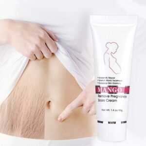 Stretch Mark Cream, Scar Cream Removal Cream Scars Essence Stretch Mark Repair Cream Stretch Scars Remove Acne Cream Stretch Mark Treatment Maternity Repair