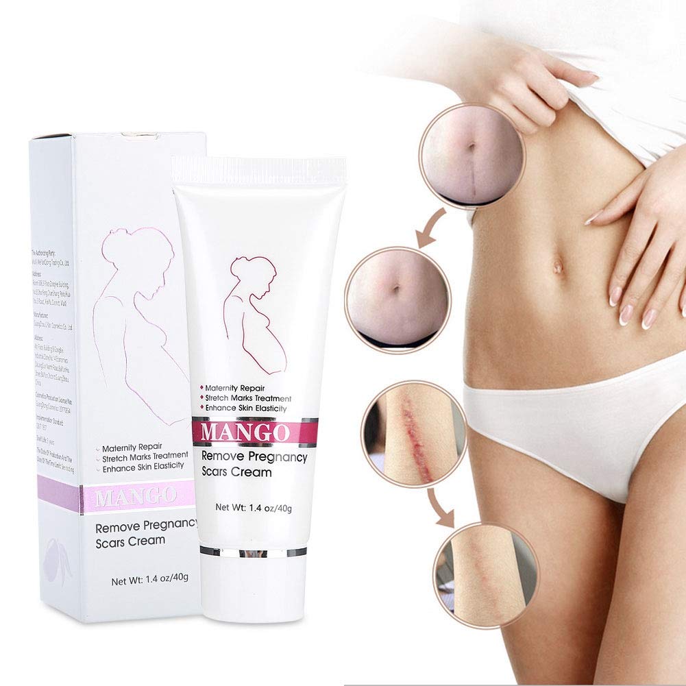 Stretch Mark Cream, Scar Cream Removal Cream Scars Essence Stretch Mark Repair Cream Stretch Scars Remove Acne Cream Stretch Mark Treatment Maternity Repair