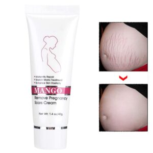 Stretch Mark Cream, Scar Cream Removal Cream Scars Essence Stretch Mark Repair Cream Stretch Scars Remove Acne Cream Stretch Mark Treatment Maternity Repair