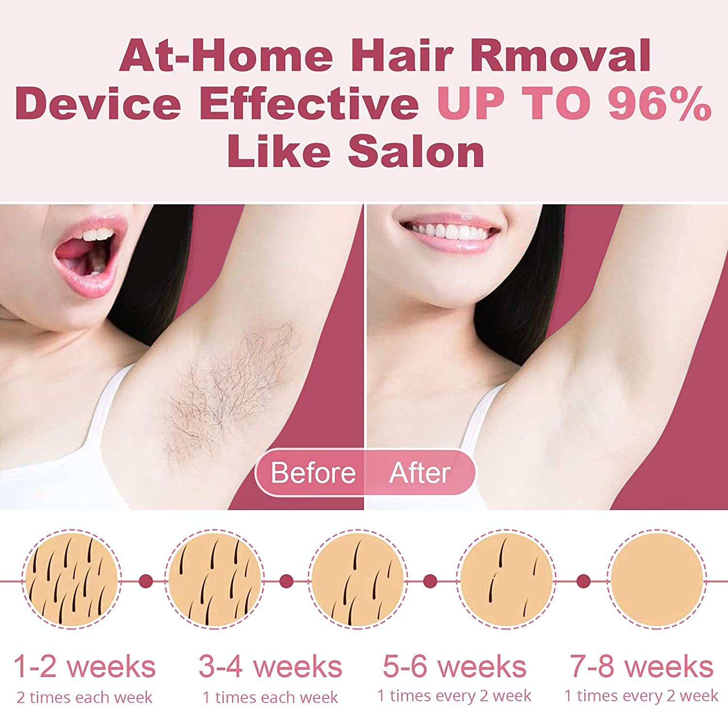 Alcyoneus IPL Hair Removal for Women Permanent, at-Home Laser Hair Removal Device, Painless Laser Hair Remover Machine, Facial Hair Removal for Women on Face, Armpits, Arms, Legs, Bikini, Chest