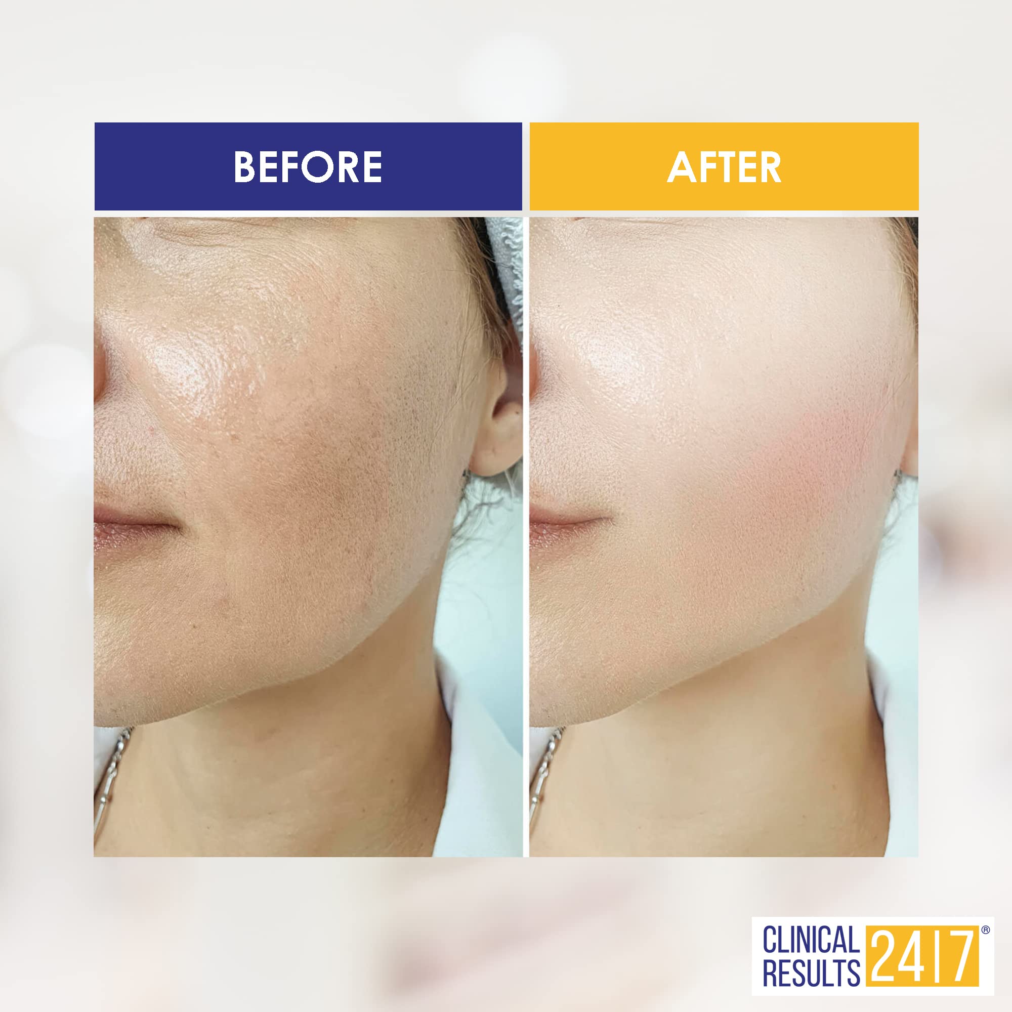 Increase Skin Hydration 161% and Firm Skin from the Lower Layers with 3D Lift PGA Serum | NASA Stem Cell & Growth Factor Technology Visibly Reduces Wrinkles |Clinical Results 24|7-8 Week Supply (1oz)