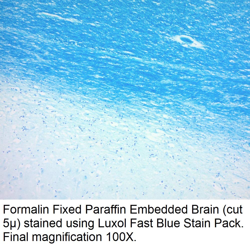 Luxol Fast Blue Stain Pack, 125ml