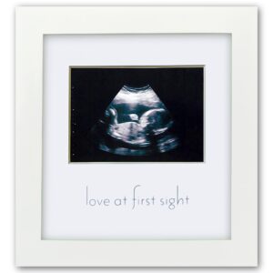 green pollywog | sonogram picture frame | white frame | ultrasound frame | pregnancy gifts for first time moms | baby ultrasound picture frame | gifts for parents/grandparents | nursery decor