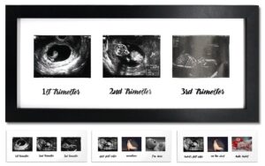 iheipye triple sonogram pregnancy frame – baby ultrasound picture frame with story for expecting parents, baby shower frame, baby grow through all three trimesters frame, nursery decor, black