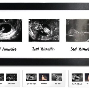 IHEIPYE Triple Sonogram Pregnancy Frame – Baby Ultrasound Picture Frame with Story for Expecting Parents, Baby Shower Frame, Baby Grow Through All Three Trimesters Frame, Nursery Decor, Black