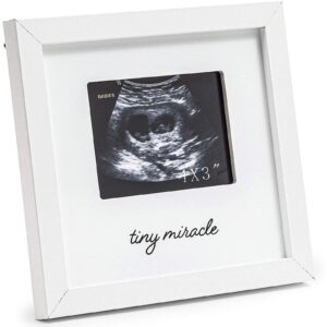 juvale white sonogram keepsake frame for 4 x 3 ultrasound photos (7 x 6.5 inches)