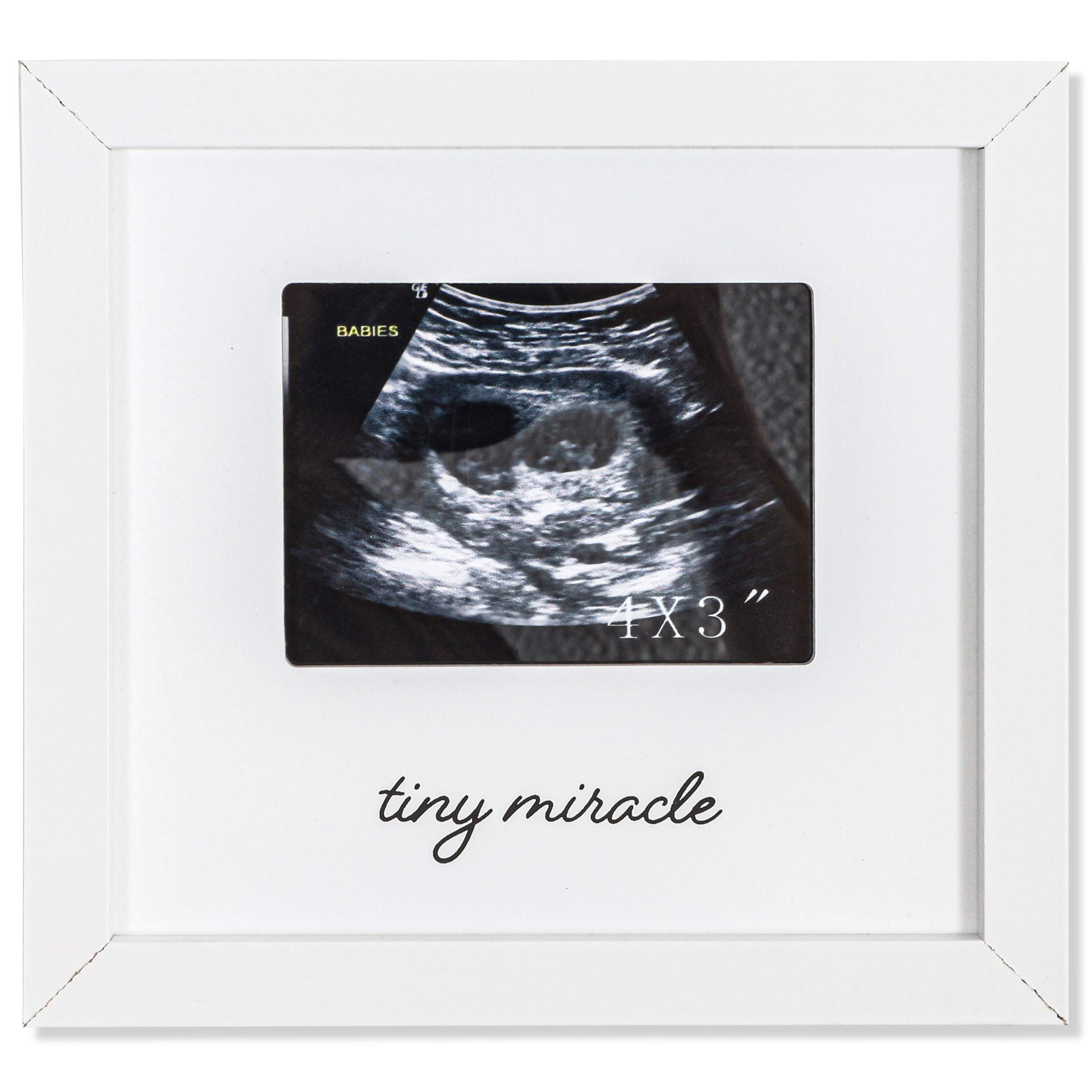 Juvale White Sonogram Keepsake Frame for 4 x 3 Ultrasound Photos (7 x 6.5 Inches)