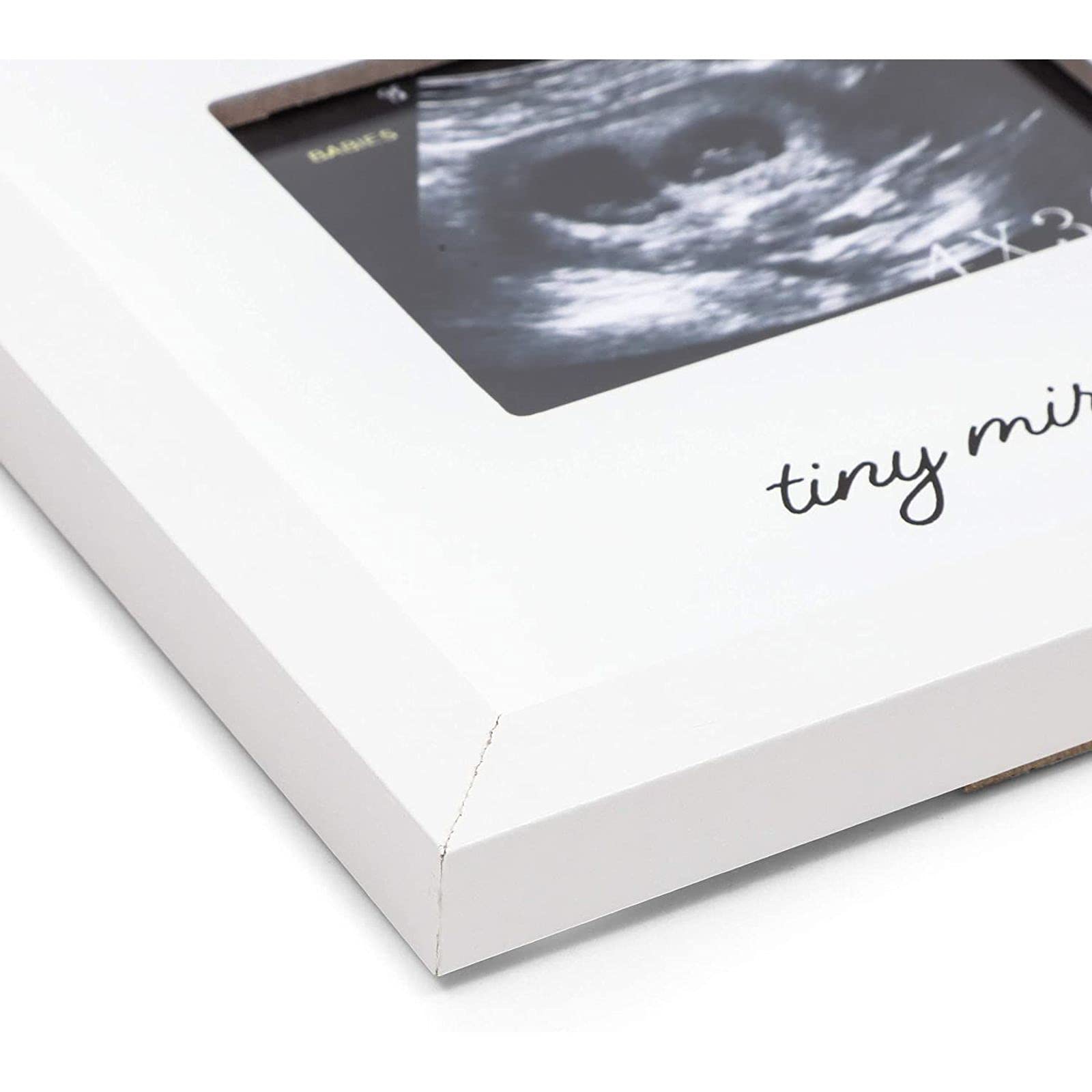 Juvale White Sonogram Keepsake Frame for 4 x 3 Ultrasound Photos (7 x 6.5 Inches)