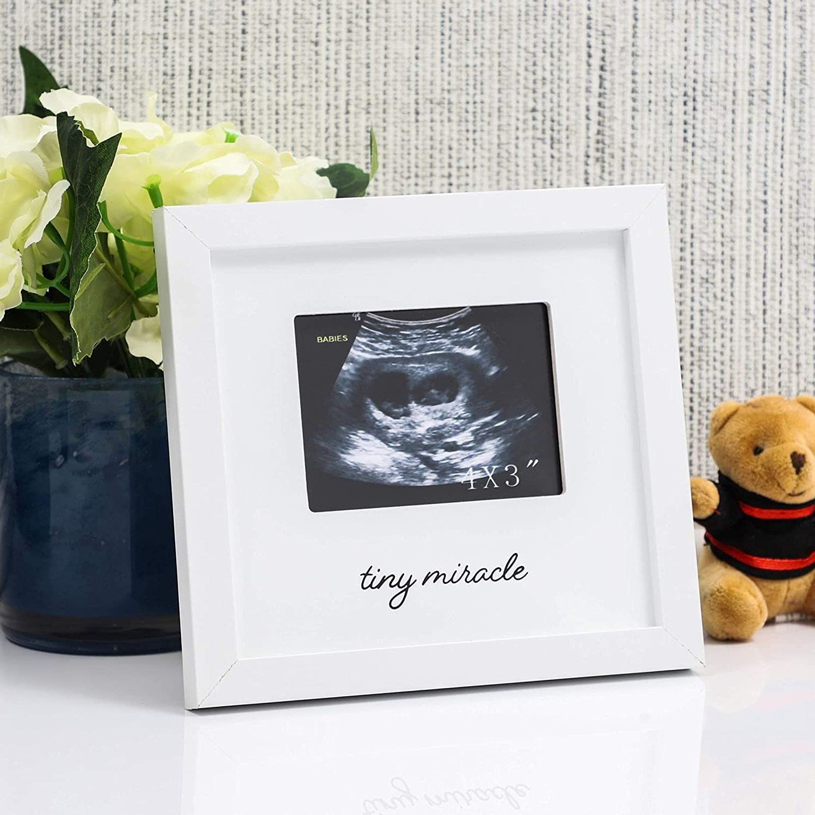 Juvale White Sonogram Keepsake Frame for 4 x 3 Ultrasound Photos (7 x 6.5 Inches)