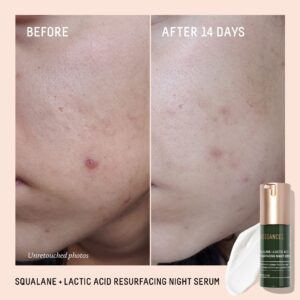 Biossance Squalane + Lactic Acid Resurfacing Night Serum. An Exfoliating AHA to Soften and Smooth Skin, Diminish Fine Lines and Brighten Complexion (1.0 ounces)