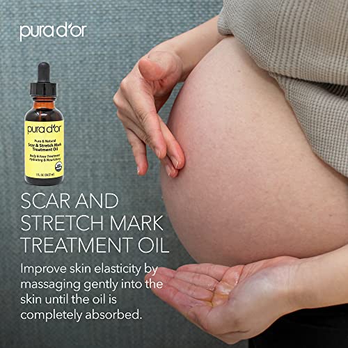 PURA D'OR Organic Scar & Stretch Mark Treatment Oil (1oz) For Skin - With Rosehip, Wheat Germ, Argan, Tamanu, Carrot, Rosemary, Lavender, Geranium, Patchouli, Sage