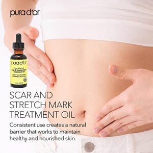 PURA D'OR Organic Scar & Stretch Mark Treatment Oil (1oz) For Skin - With Rosehip, Wheat Germ, Argan, Tamanu, Carrot, Rosemary, Lavender, Geranium, Patchouli, Sage