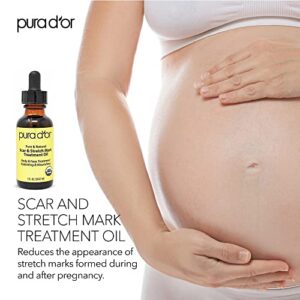 PURA D'OR Organic Scar & Stretch Mark Treatment Oil (1oz) For Skin - With Rosehip, Wheat Germ, Argan, Tamanu, Carrot, Rosemary, Lavender, Geranium, Patchouli, Sage