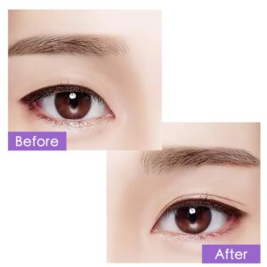 Ultra Invisible Double Eyelid Tape Stickers - 200Pcs/100Pairs Both Side Sticky Instant Eye Lid Lift Strips - Perfect for Hooded Droopy Uneven or Mono-eyelids