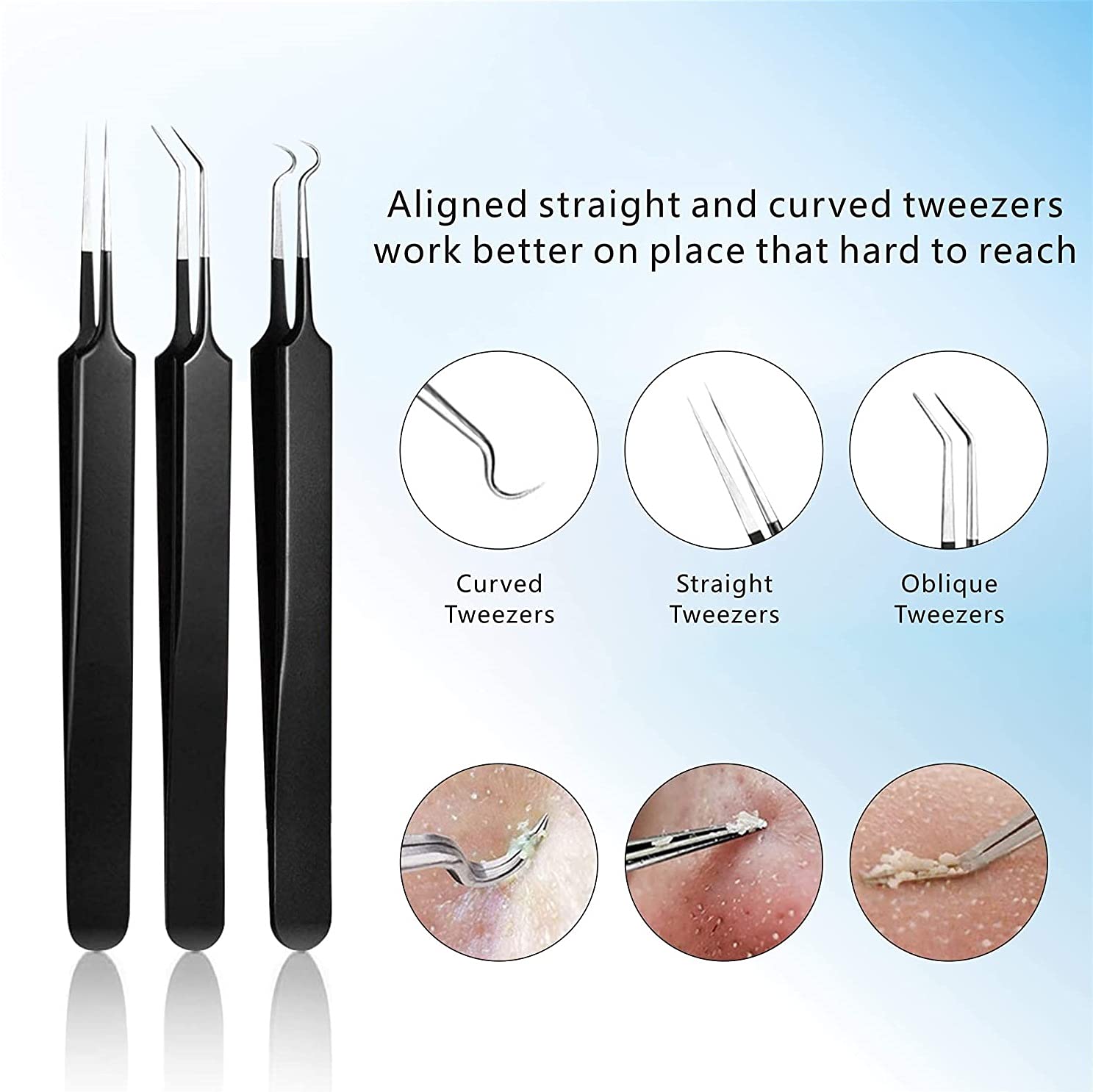 Pimple Popper Tool Kit 11 Pcs, Ybaoo Blackhead Remover Pimple Extractor Tools with Metal Case for Quick and Easy Removal of Blackheads,Pimples,Whiteheads,Zit Popper,Forehead,Facial and Nose (Black)