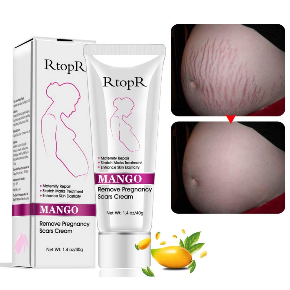 Scars Removal Cream, Mango Remove Pregnancy Scars Cream Stretches Marks Treatment Maternity Repair Firming Skin