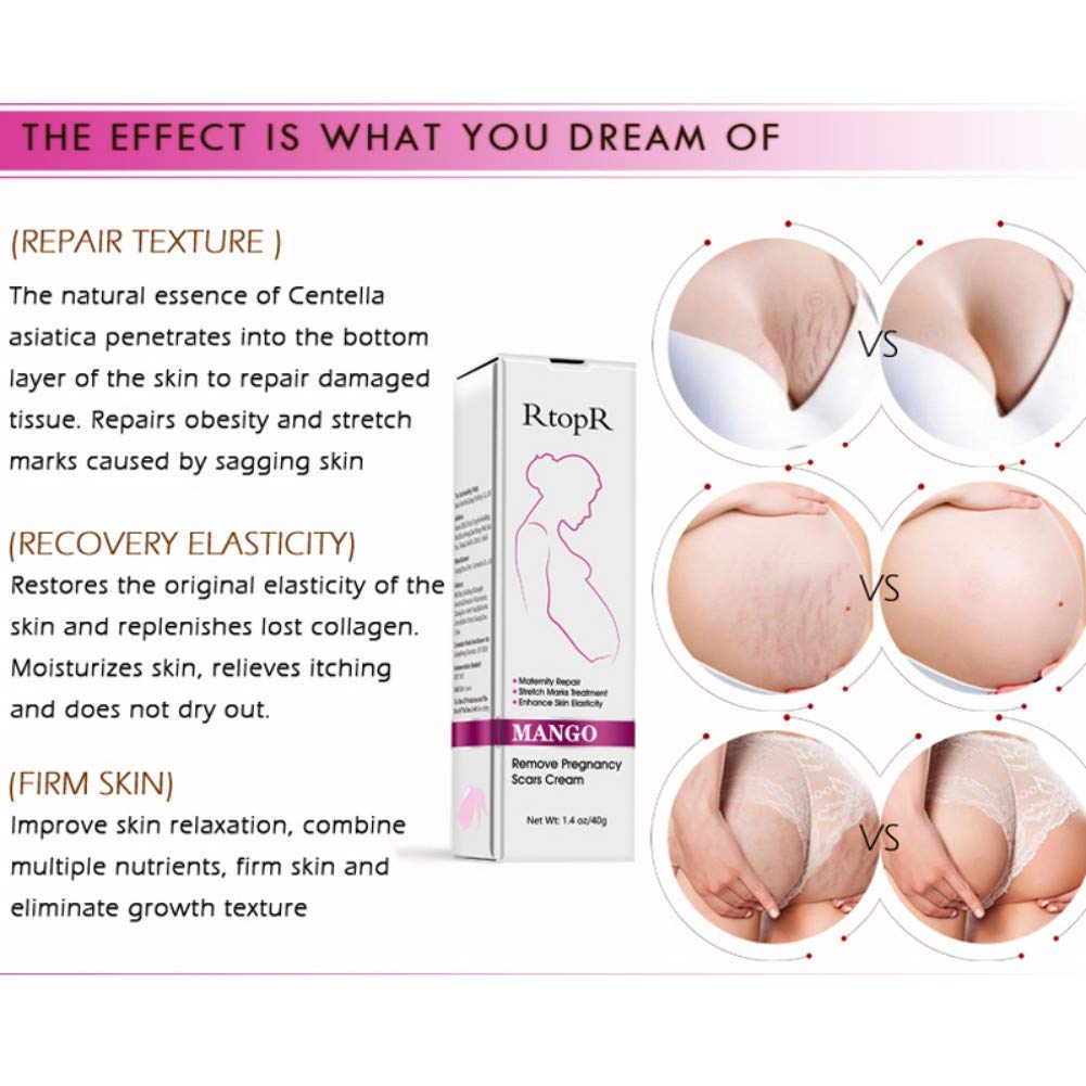 6pcs Scars Removal Cream, Mango Remove Pregnancy Scars Cream Stretches Marks Treatment Maternity Repair Firming Skin