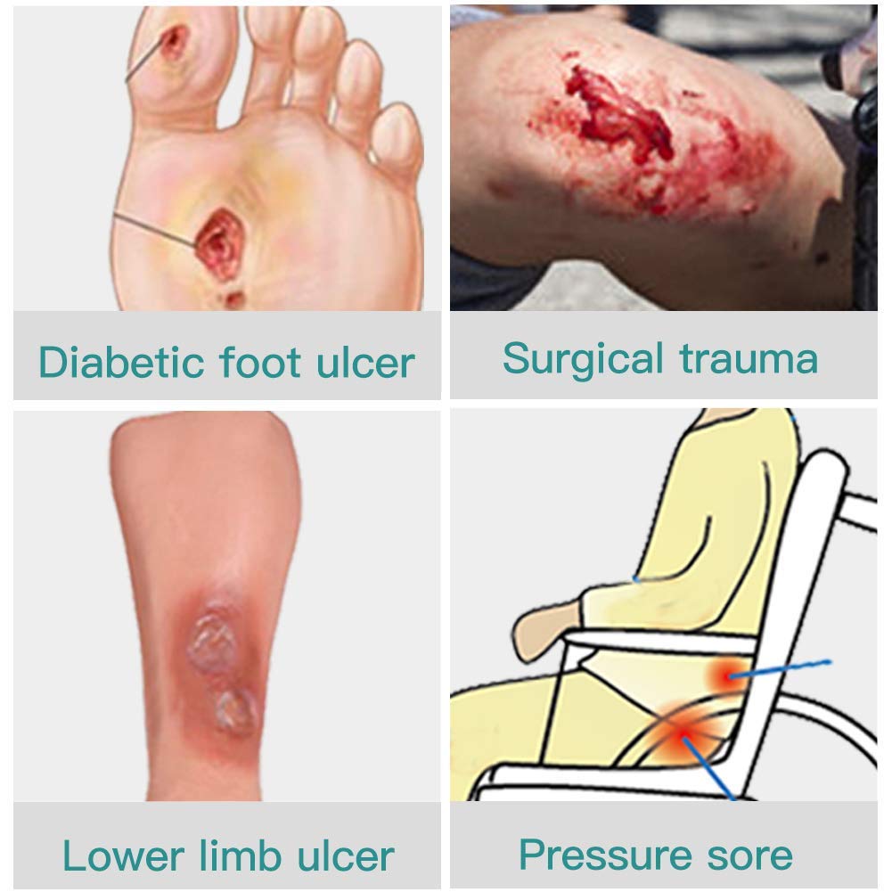 Dimora Calcium Alginate Wound Dressing, 4'' x 4'' Patches & Hydrocolloid Dressing 4'' x 4'', Sterile Self-Adhesive Patches