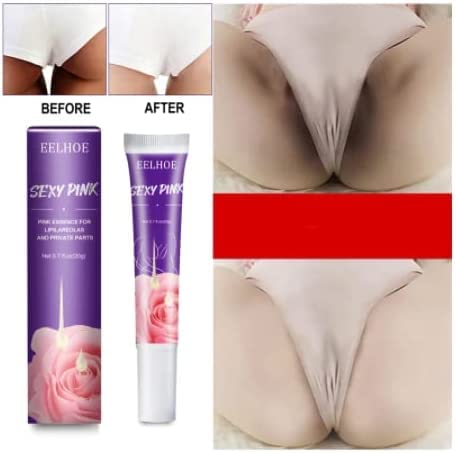 Intimate Bleaching Cream for Women,Crema blanqueadora íntima para mujeres,Underarm Bleaching Serum Whiten Butt Knee Brighten Inner Thigh Intimate Parts Dark Remove Melanin (1pcs,B-20ML)