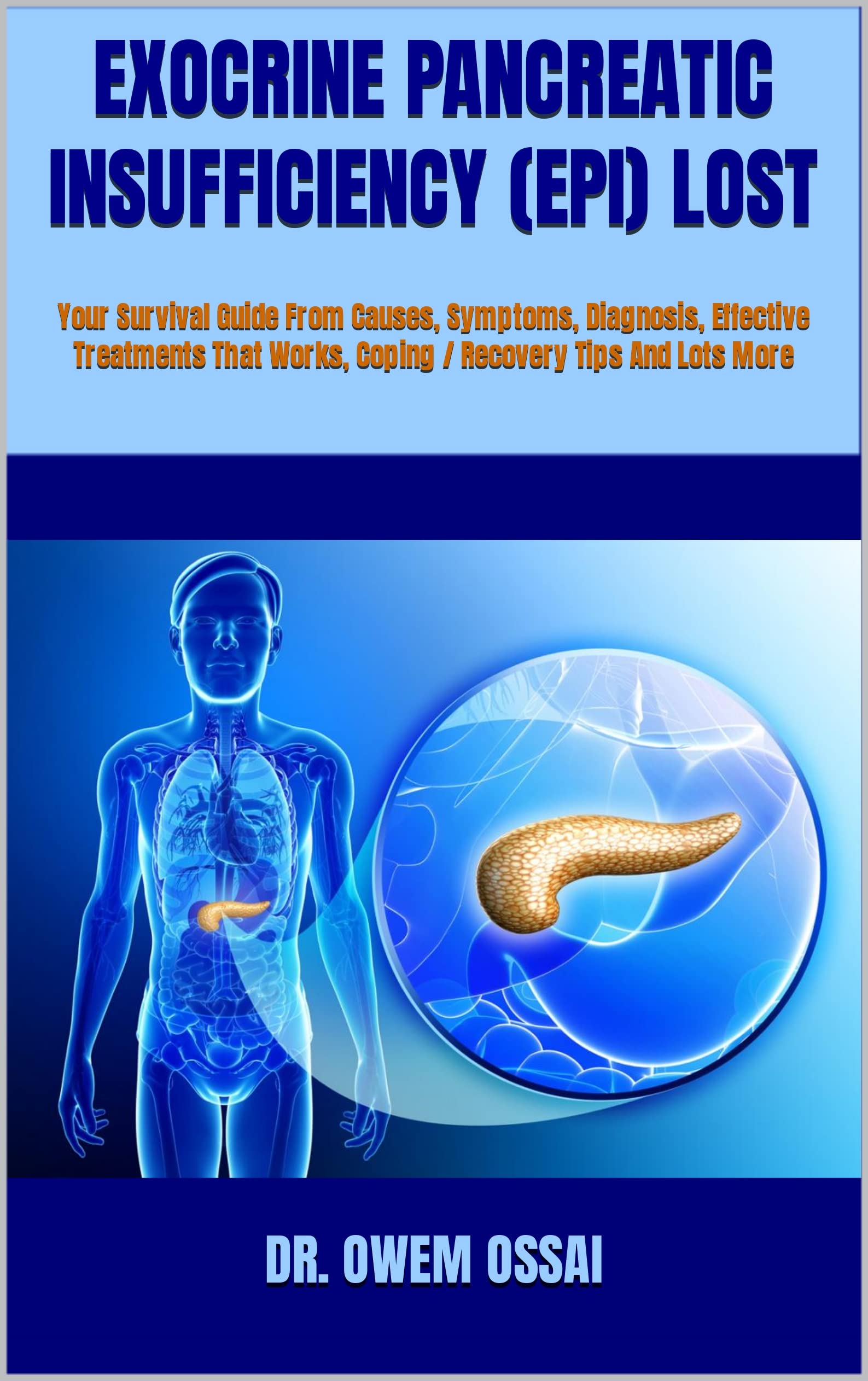 EXOCRINE PANCREATIC INSUFFICIENCY (EPI) LOST : Your Survival Guide From Causes, Symptoms, Diagnosis, Effective Treatments That Works, Coping / Recovery Tips And Lots More