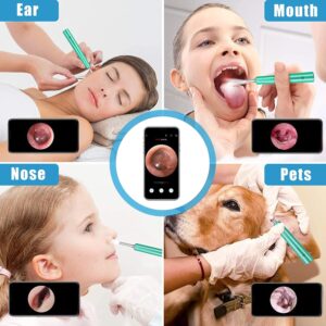 BEBIRD C3 Ear Wax Removal Tool with Ear Camera, Ear Cleaner with 1080P HD Otoscope, 6 LED Light and 4pcs Ear Scoops Replacement Cleaning Kit, Earwax Camera for iOS and Android, Green