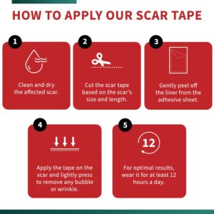 Medical-Grade Silicone Scar Tape Roll (1.6" x 118") Silicone Scar Sheets Keloid Bump Removal - Reusable Silicone Tape Scar Removal Strips, Scar Tape for Surgical Scars, C Section Scar Silicone Strips