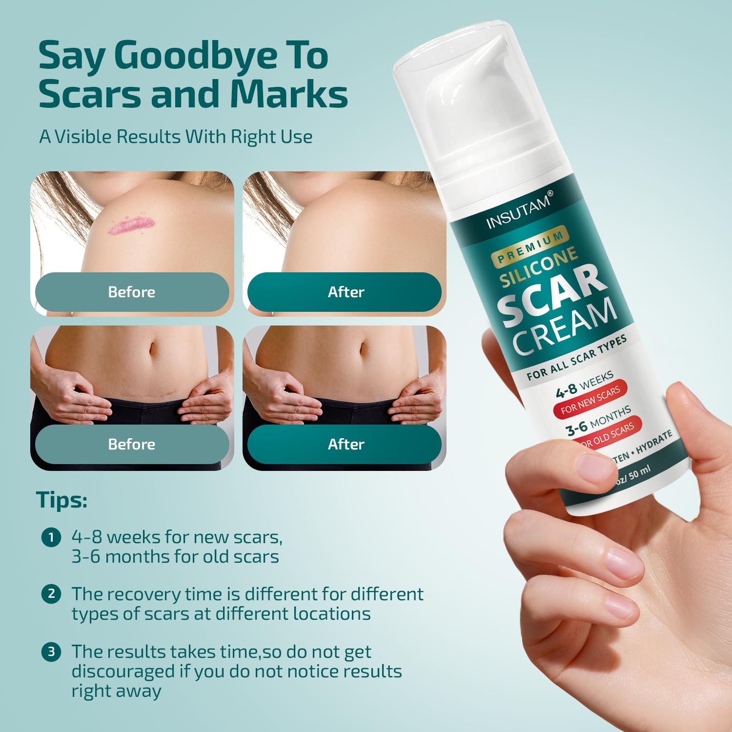 Silicone Scar Cream Gel for Scars: Medical Grade Silicone for Old and New Scars