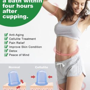 Silicone Cupping Therapy Sets, Anti Cellulite Cup Massager - Vacuum Suction Cup for Cellulite Treatment - Amazing Cellulite Remover