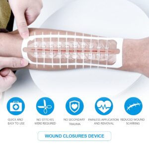 Large Butterfly Bandaids, Steri Strips Wound Closure, Emergency Wound Closure Device Surgical Laceration Repair without Stitches for Extra Large Wound Care, Ahead Be Prepared (PU)