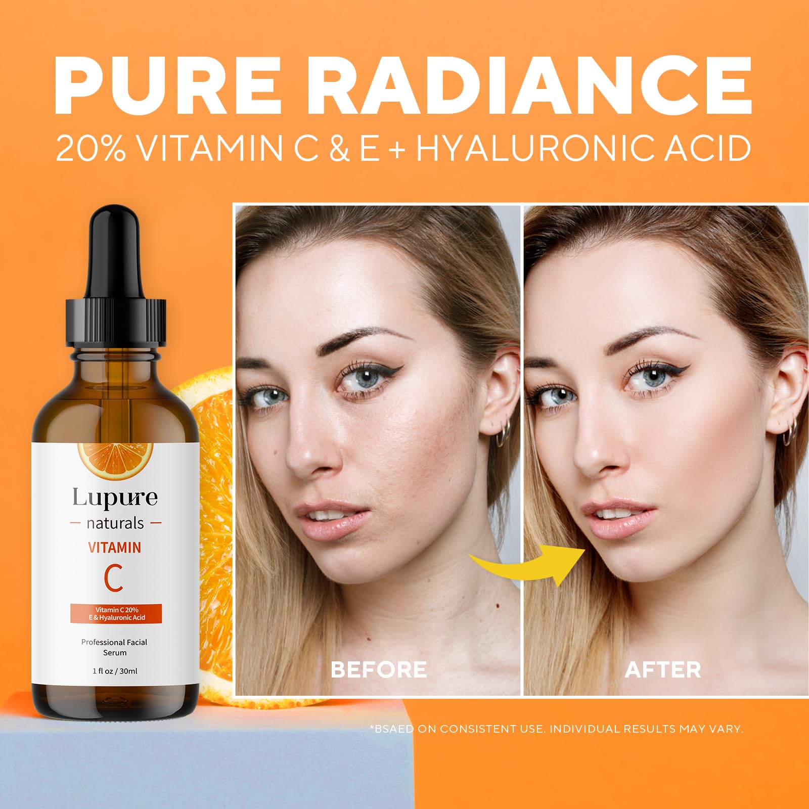 Lupure Professional Vitamin C Face Serum 20%, Anti Aging Facial Super Vit C Serum with Hyaluronic Acid & Vitamin E for Dark Spots, Skin Care, Christmas Gift & Stocking Stuffers | 1 Fl. Oz