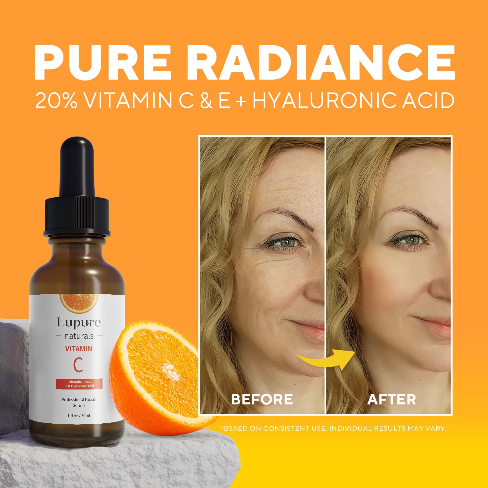 Lupure Professional Vitamin C Face Serum 20%, Anti Aging Facial Super Vit C Serum with Hyaluronic Acid & Vitamin E for Dark Spots, Skin Care, Christmas Gift & Stocking Stuffers | 1 Fl. Oz