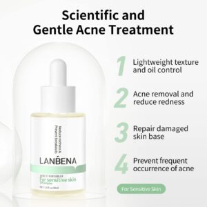 Acne Treatment Face Serum, 10% Salicylic Acid, Pimples Remover & Dead Skin Peels, Relieve Redness Rosacea Blemish, Centella Asiatica Soothing Calming, Acne Prone Sensitive Facial Skin Care, 30ml