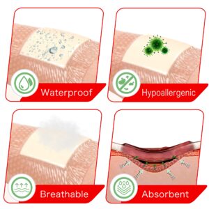 FRESINIDER Silicone Foam Dressing with Adhesive Border – Wound Dressing Bandage – Silicone Foam Pad – Pack of 5 – 4 x 4 Inches Large Waterproof Bandages – Self Adhesive Wound Care and Dressings