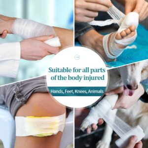 Gauze Rolls White Gauze Bandages for First Aid Wound Care and Medical Supplies Breathable Gauze Packets Latex Free Stretchable 3.1" x 6.5 Yard 12 Rolls