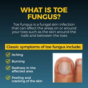 Fungi-Nail Anti-Fungal Liquid Solution, Kills Fungus That Can Lead to Nail & Athlete's Foot with Tolnaftate & Clinically Proven to Cure and Prevent Fungal Infections 1 Fl Oz (Pack of 1)