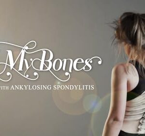 In My Bones: Living With Ankylosing Spondylitis