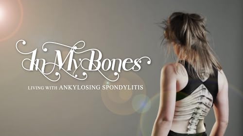 In My Bones: Living With Ankylosing Spondylitis