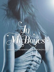 in my bones: living with ankylosing spondylitis