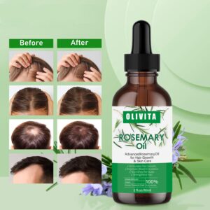 Hair Growth Serum, Rosemary Oil for Organic, Dry Damaged and Growth, Scalp Treatment, Thickening Moisture Loss Regrowth