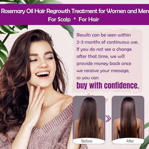 Rosemary Oil Hair Growth Serum W/Rosemary Water & Rice Water Spray Hair Growth,Biotin Castor Oil Argan Oil Caffeine Keratin Reduce Hair Loss,Restore Dry Damaged Hair Regrowth Treatments for Women Men