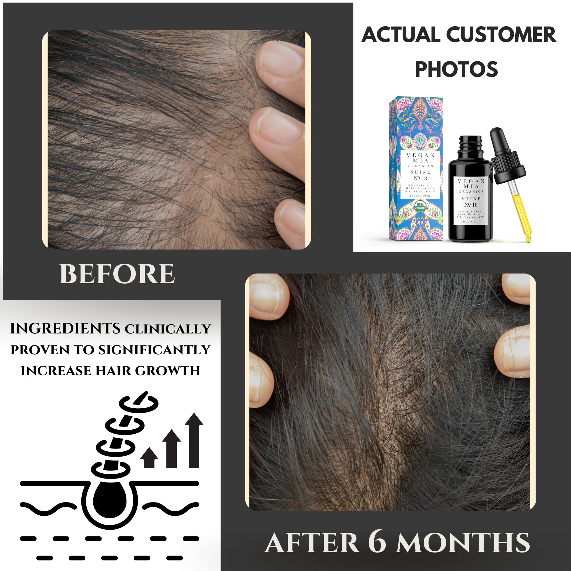 Vegan Mia USDA Organic Rosemary Oil for Hair Growth with Castor Oil & Jojoba Oil - Scalp Oil Treatment & Intense Nourishment to Get Healthier, Thicker & Shiny Hair Naturally