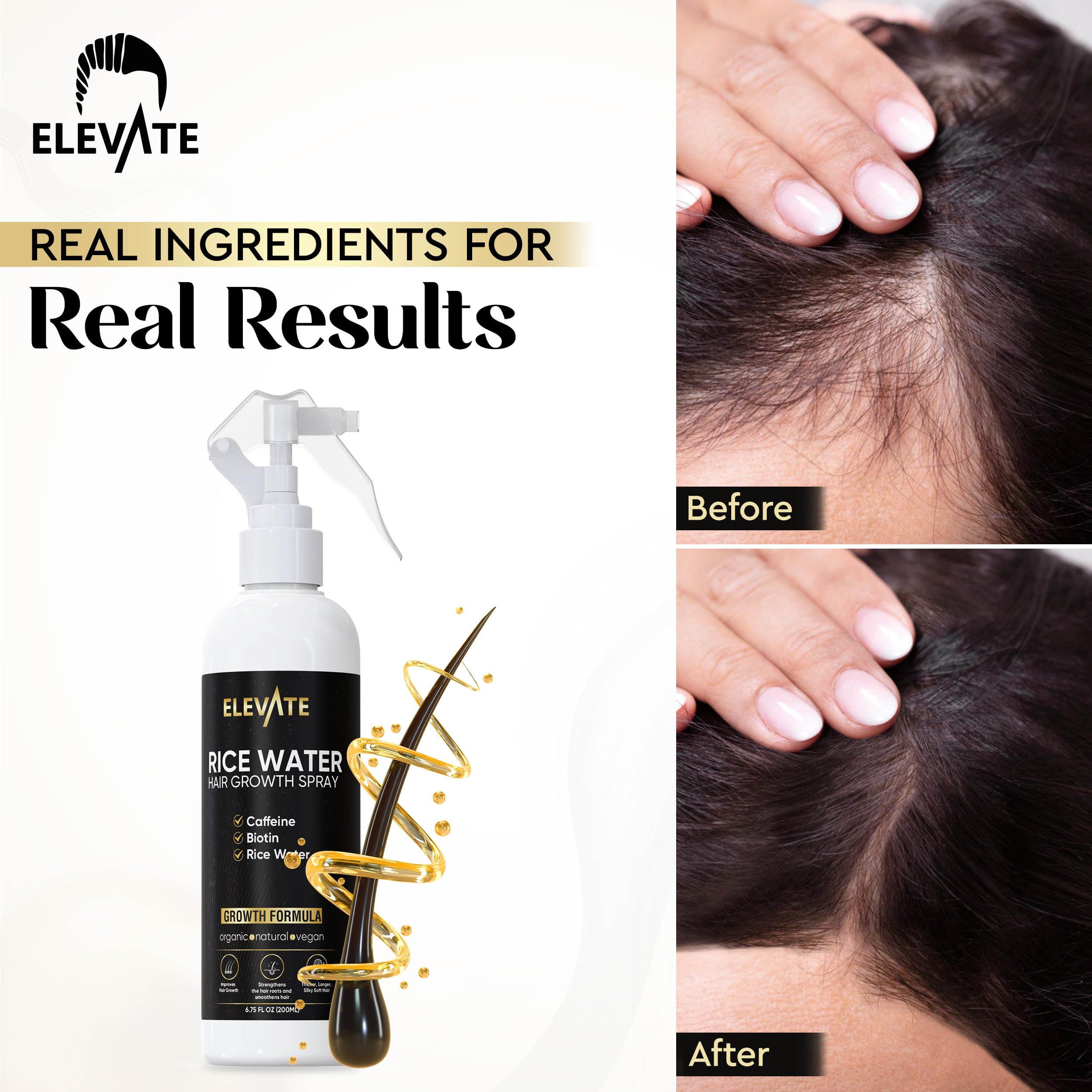 Elevate Rice Water Spray for Hair Growth Infused Biotin Caffeine & Aloe Vera - Fermented Rice Water Leave In Hair Mist For Thinning Damaged Hair - Vegan Non-Greasy Naturally Thicker Longer Softer Hair