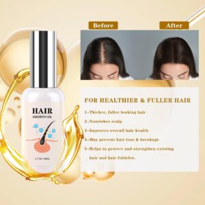 Hair Growth Oil - Rice Water For Hair Growth For Women & Men, Hair Loss Treatments, Serum For Thicker Longer Fuller Healthier Hair, Biotin & Castor Oil & Rosemary Oil 50ml