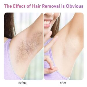 ONE BEAUTY IPL Hair Removal for Women and Men, Ice-Cooling, Ice Painless Laser Hair Removal, FDA Cleared, Permanent Hair Removal Device for Facial Whole Body, 999999 Flashes Hair Remover with 5 Modes