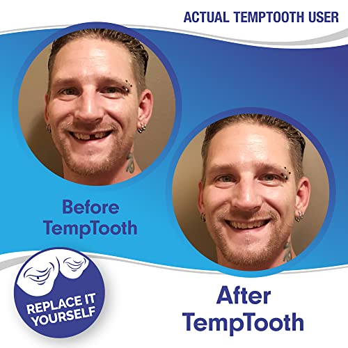 Temptooth #1 Seller Trusted Patented Temporary Tooth Replacement Product