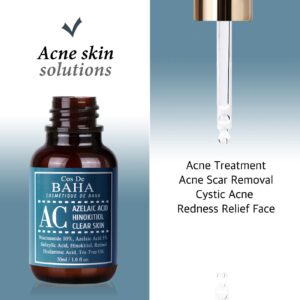 Azelaic Acid + Tea Tree Clear Skin Facial Serum with Niacinamide 10%, Salicylic Acid, Retinol - Fast & Efficient Cystic Acne, Age-Defying, Relieve Trouble Skin Formula, 1 Fl Oz (30ml)