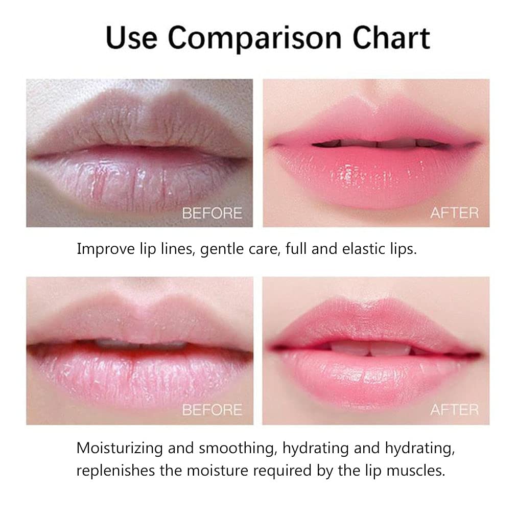 20Pcs Moisturizing/Plumping Lip Mask, Restores Moisture Mask for Dry Lips and Lines Overnight Care, Gel Treatment Masks ​ (Pink)