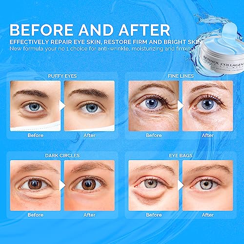 Enaskin Naturals Under Eye Patches for Dark Circles: 30 Pairs Retinol Collagen Eye Gels Mask - Reduce Wrinkles Puffy & Bags - Skin Treatment Pads - Anti Aging Moisturizer For Women (Blue)