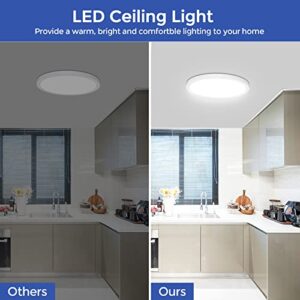 DEALGADGETS Flush Mount Ceiling Light Fixtures,24W Flat led Light for Ceiling,6000K 2200LM Ultra Thin Round White Lamp for Bedroom Kitchen,Bathroom,Garage,Living Room, Dining Room